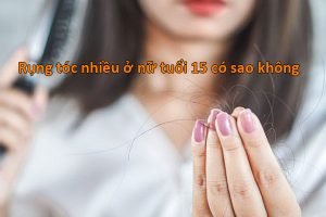 rụng tóc nhiều ở nữ tuổi 15 có sao không